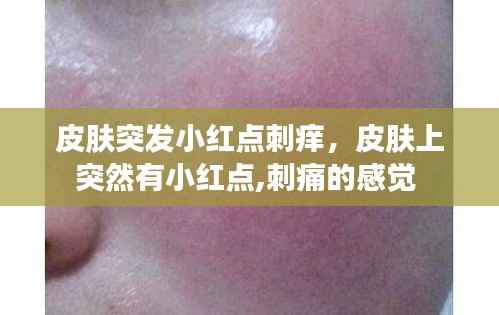 皮肤突发小红点刺痒,皮肤上突然有小红点,刺痛的感觉